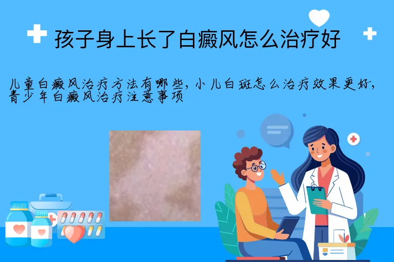 孩子身上长了白癜风怎么治疗好
