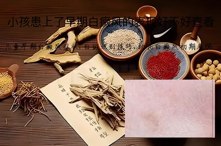 小孩患上了早期白癜风的表现好不好查看