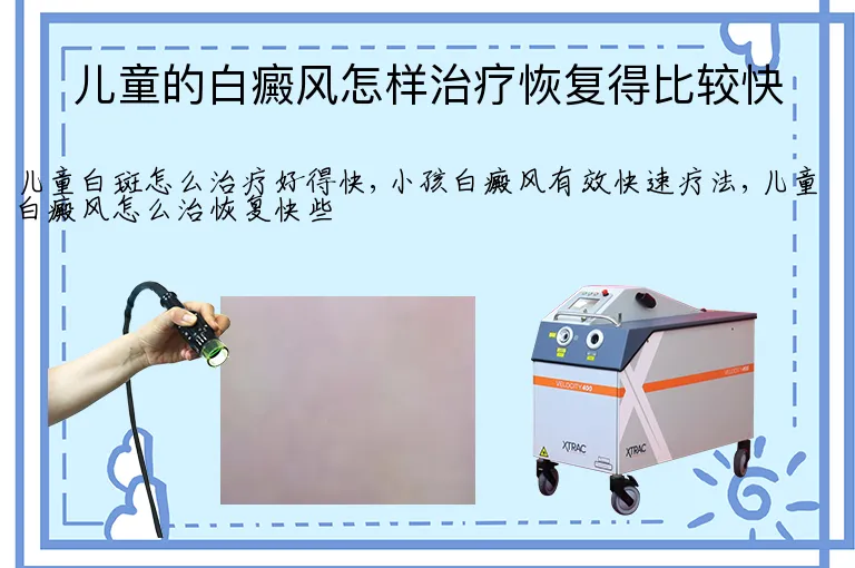 儿童的白癜风怎样治疗恢复得比较快