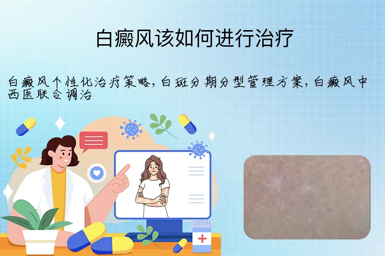 白癜风该如何进行治疗