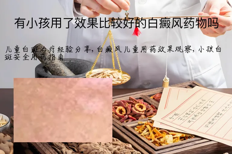 有小孩用了效果比较好的白癜风药物吗