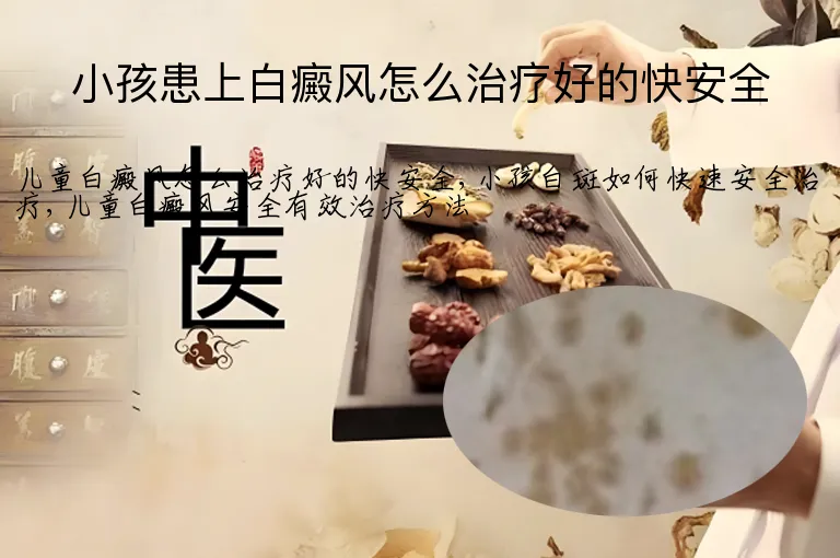 小孩患上白癜风怎么治疗好的快安全