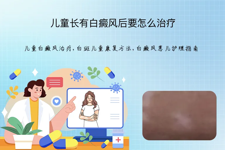 儿童长有白癜风后要怎么治疗