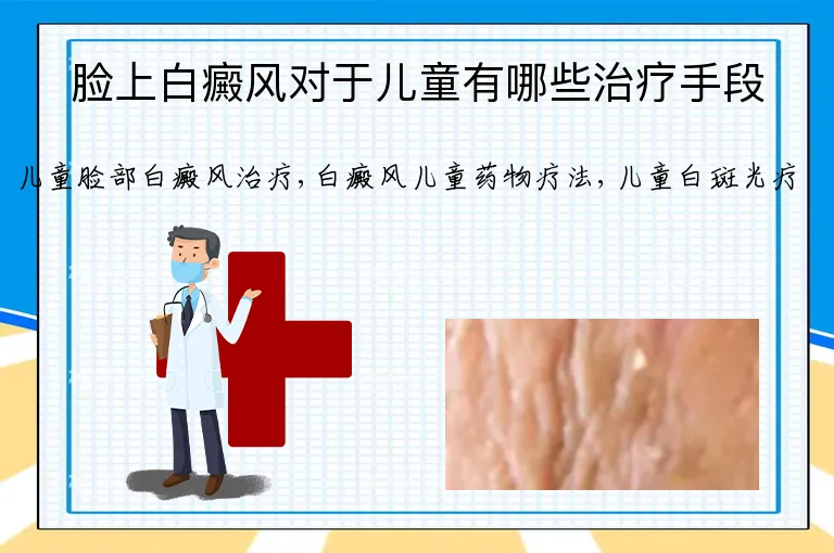 脸上白癜风对于儿童有哪些治疗手段
