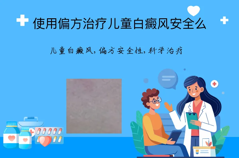使用偏方治疗儿童白癜风安全么