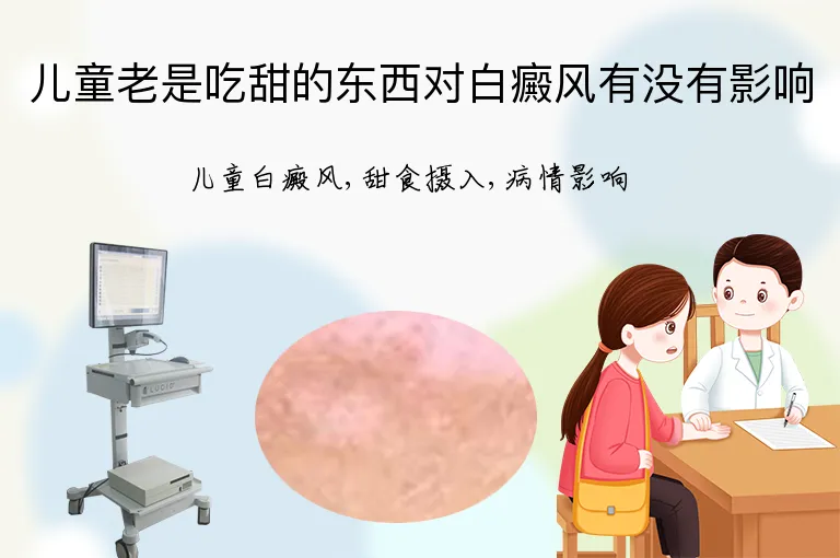 儿童老是吃甜的东西对白癜风有没有影响