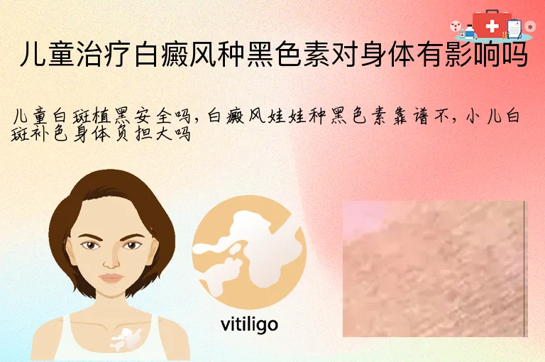儿童治疗白癜风种黑色素对身体有影响吗