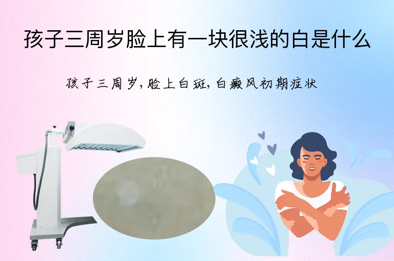 孩子三周岁脸上有一块很浅的白是什么