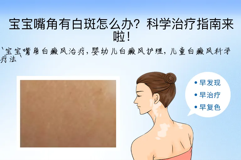 宝宝嘴角有白斑怎么办？科学治疗指南来啦！