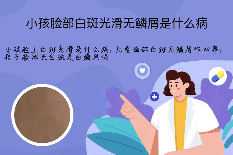 小孩脸部白斑光滑无鳞屑是什么病