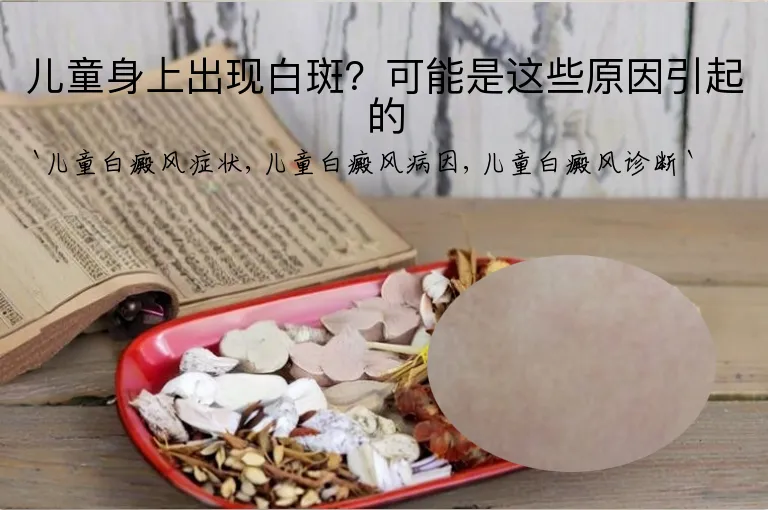 儿童身上出现白斑？可能是这些原因引起的