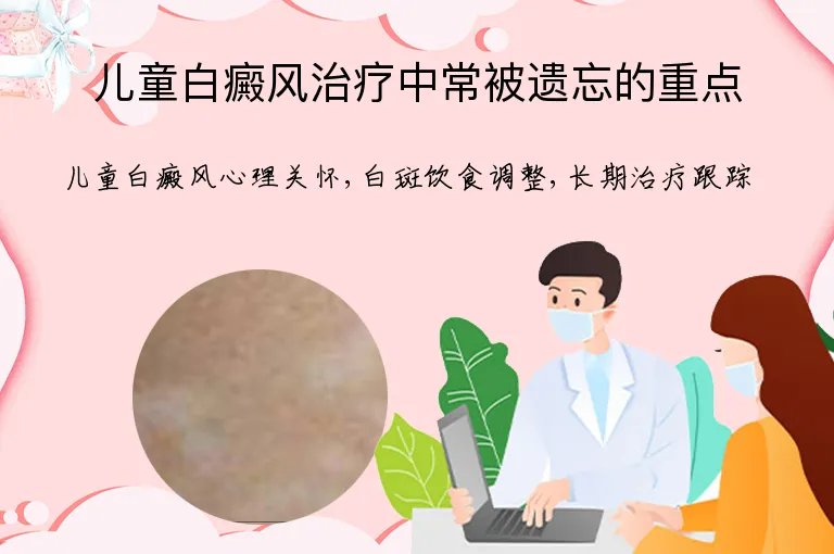 儿童白癜风治疗中常被遗忘的重点