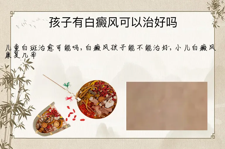 孩子有白癜风可以治好吗