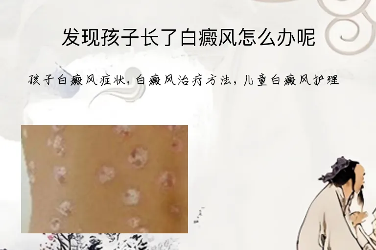 发现孩子长了白癜风怎么办呢
