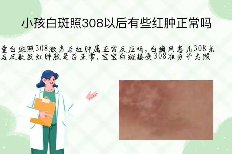小孩白斑照308以后有些红肿正常吗