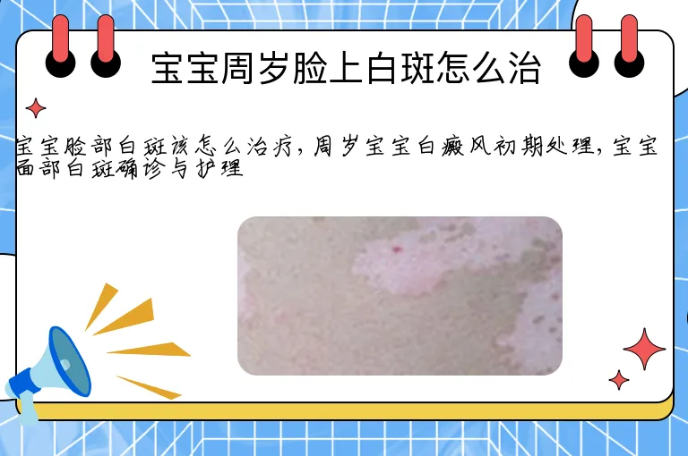 宝宝周岁脸上白斑怎么治