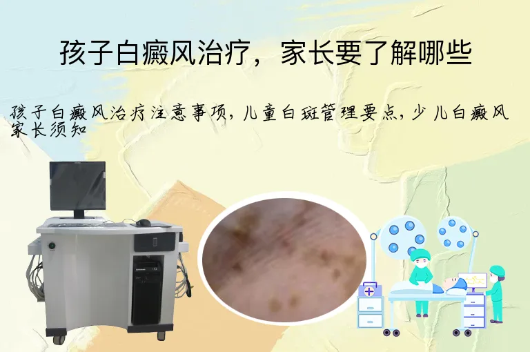 孩子白癜风治疗，家长要了解哪些
