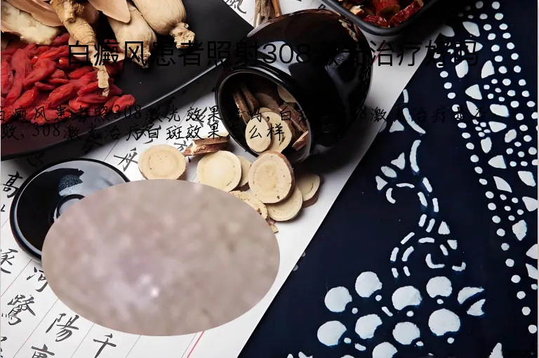 白癜风患者照射308激光治疗好吗