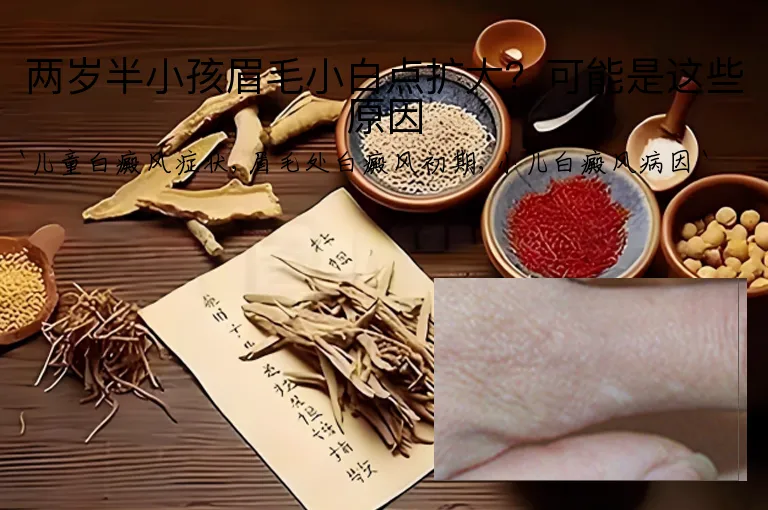 两岁半小孩眉毛小白点扩大？可能是这些原因