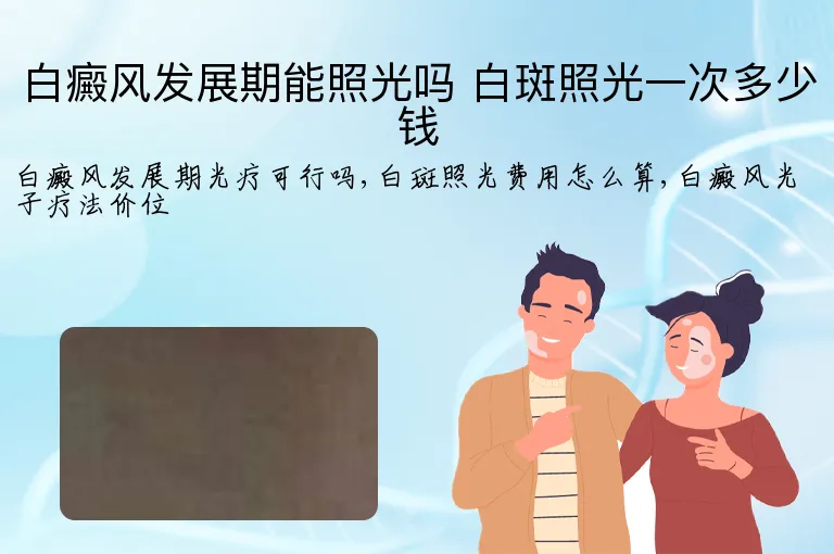 白癜风发展期能照光吗 白斑照光一次多少钱