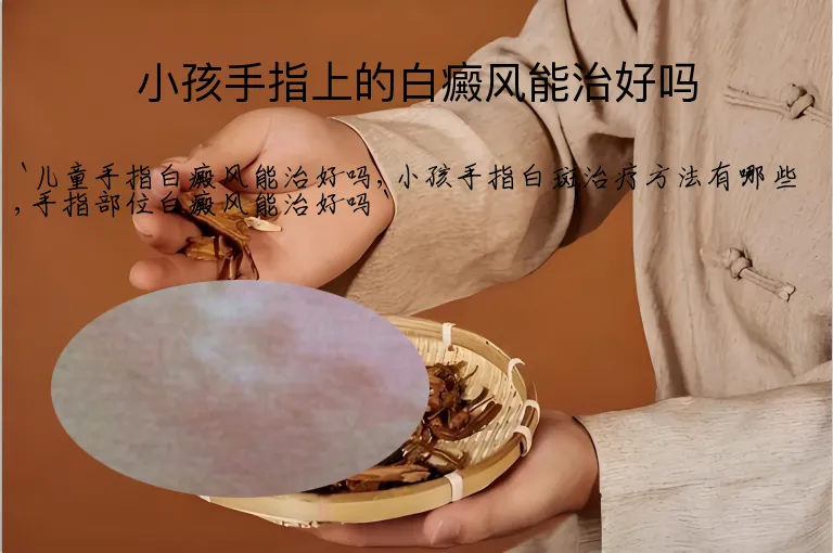 小孩手指上的白癜风能治好吗