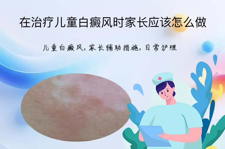 在治疗儿童白癜风时家长应该怎么做