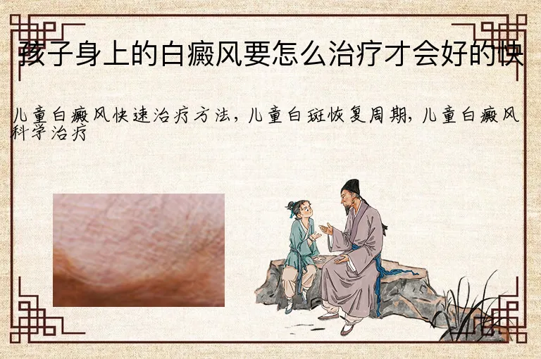孩子身上的白癜风要怎么治疗才会好的快
