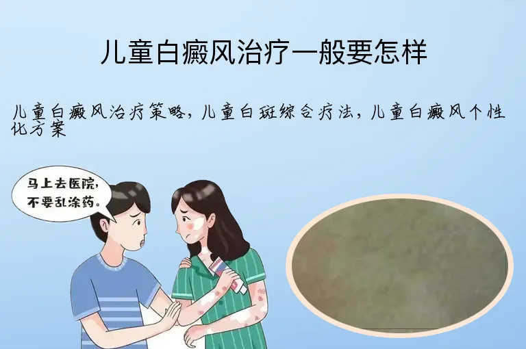 儿童白癜风治疗一般要怎样