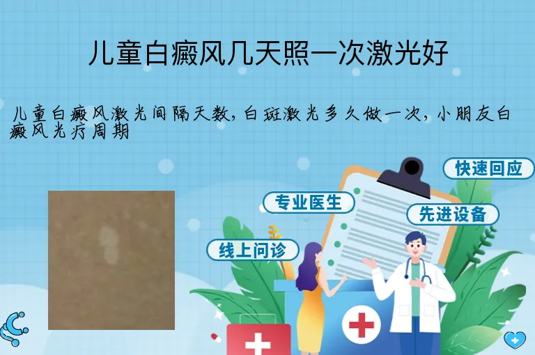 儿童白癜风几天照一次激光好