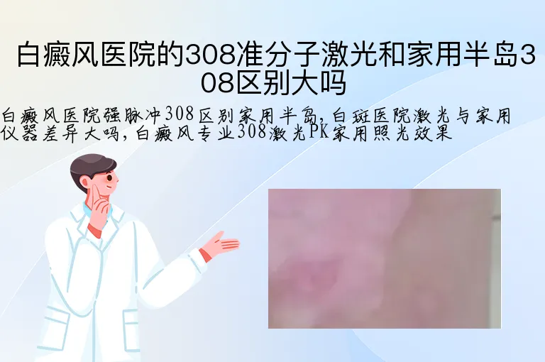 白癜风医院的308准分子激光和家用半岛308区别大吗