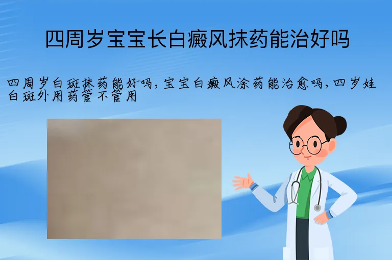 四周岁宝宝长白癜风抹药能治好吗