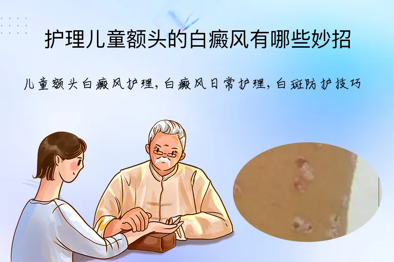 护理儿童额头的白癜风有哪些妙招