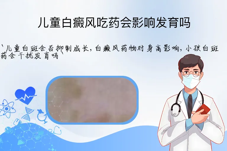 儿童白癜风吃药会影响发育吗