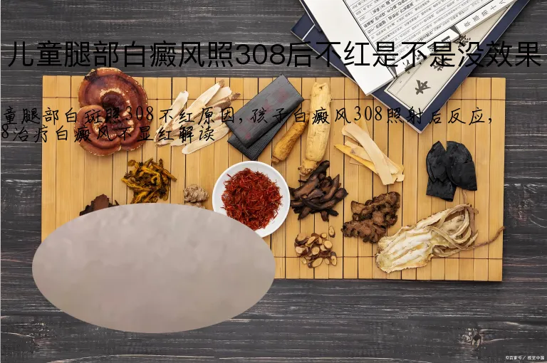 儿童腿部白癜风照308后不红是不是没效果