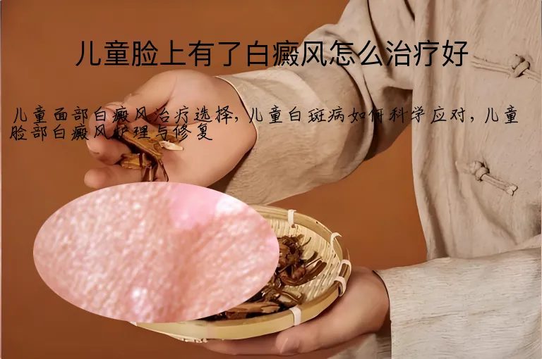 儿童脸上有了白癜风怎么治疗好