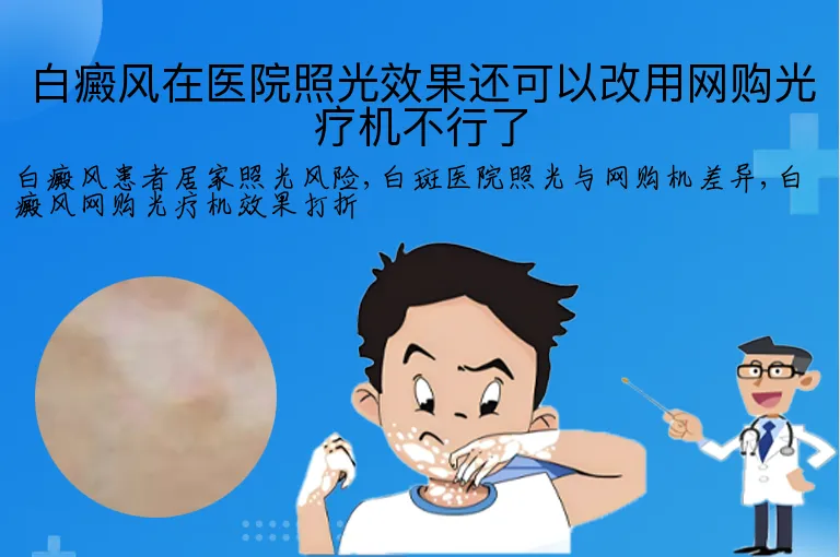 白癜风在医院照光效果还可以改用网购光疗机不行了