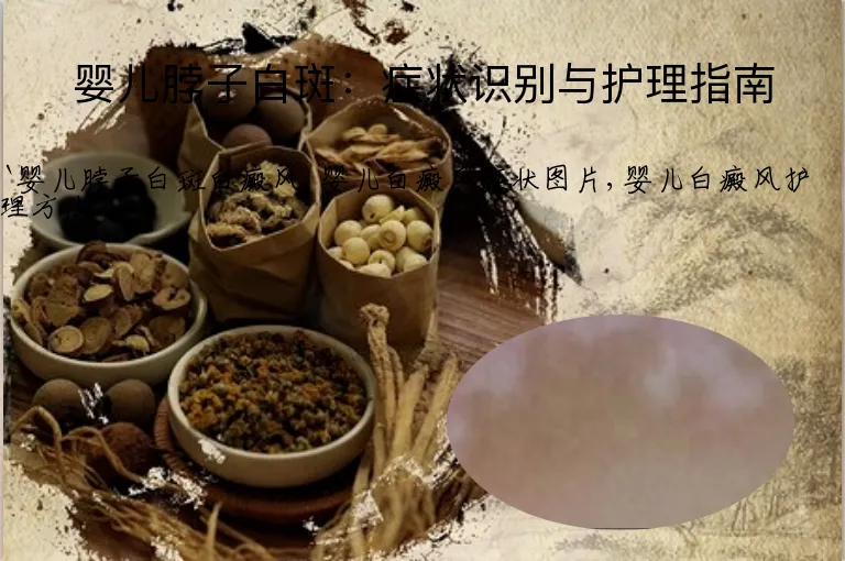 婴儿脖子白斑：症状识别与护理指南