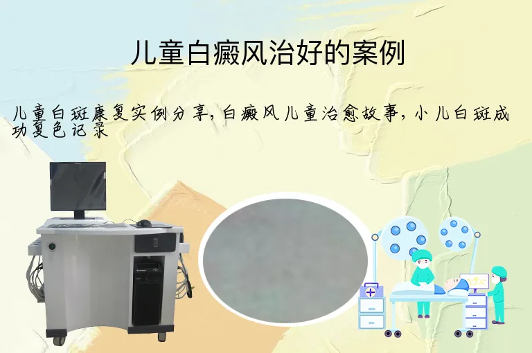 儿童白癜风治好的案例