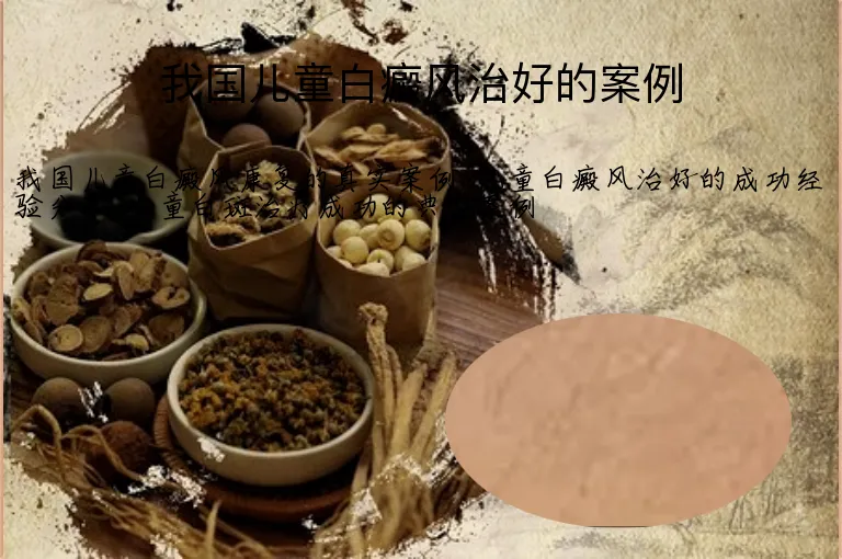 我国儿童白癜风治好的案例