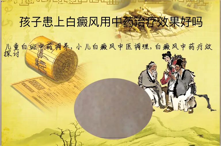孩子患上白癜风用中药治疗效果好吗