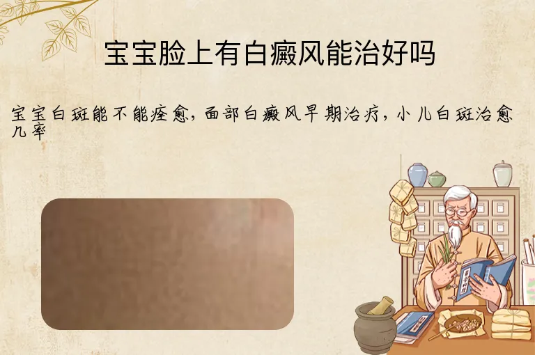 宝宝脸上有白癜风能治好吗