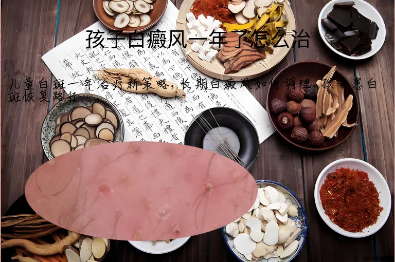 孩子白癜风一年了怎么治