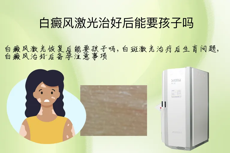 白癜风激光治好后能要孩子吗