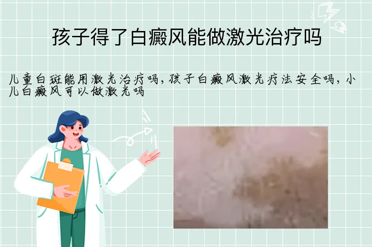 孩子得了白癜风能做激光治疗吗