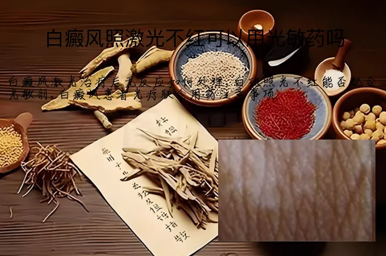 白癜风照激光不红可以用光敏药吗