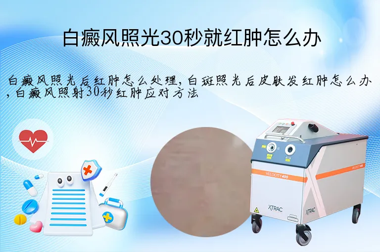 白癜风照光30秒就红肿怎么办