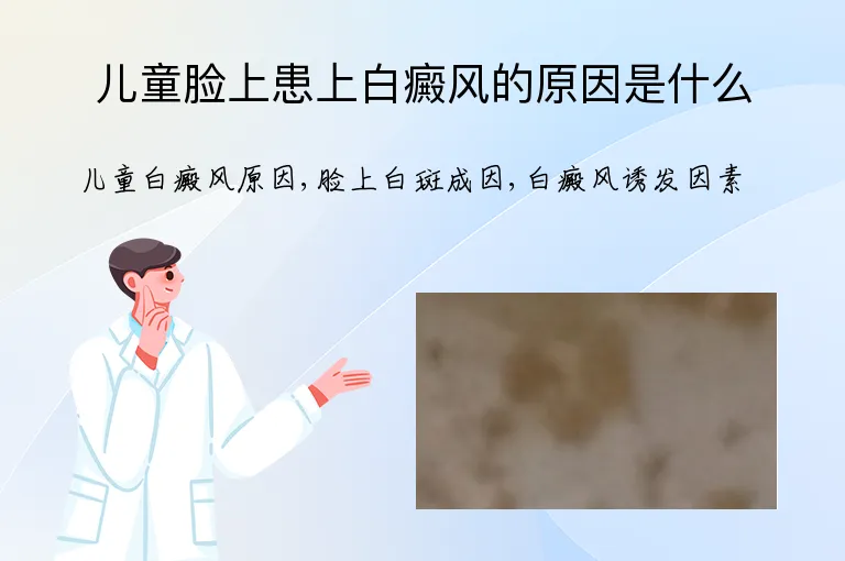 儿童脸上患上白癜风的原因是什么