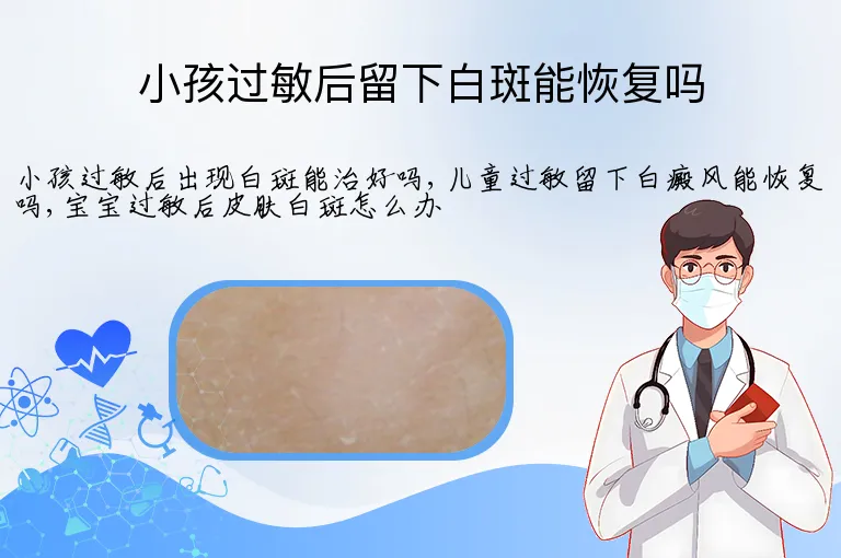 小孩过敏后留下白斑能恢复吗