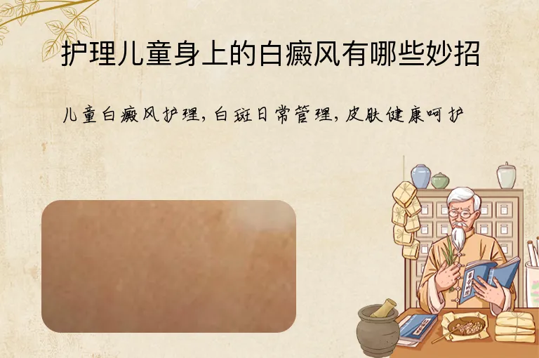 护理儿童身上的白癜风有哪些妙招