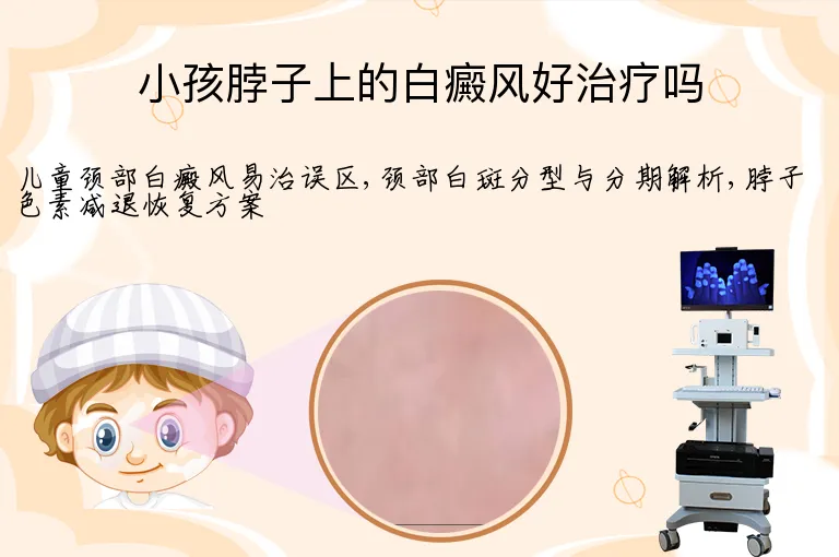 小孩脖子上的白癜风好治疗吗